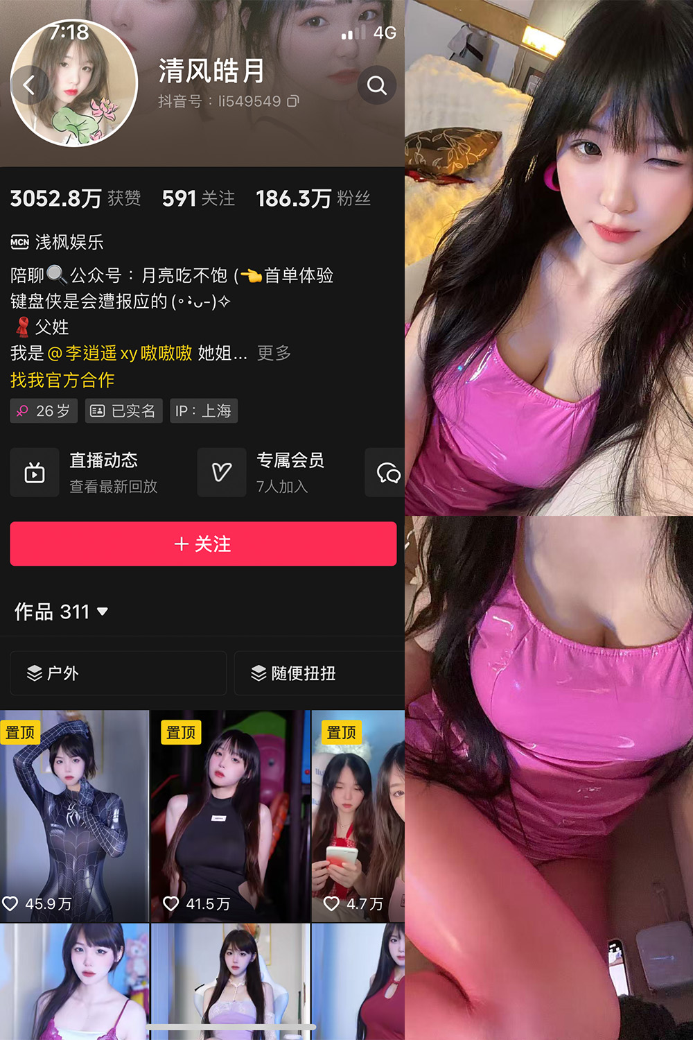 抖音 清风皓月 微密圈照片资源   NO.003期 【18P6V】最新至:2025.5.25 抖音 清风皓月 微密圈照片资源   NO.003期 【18P6V】最新至:2025.5.25