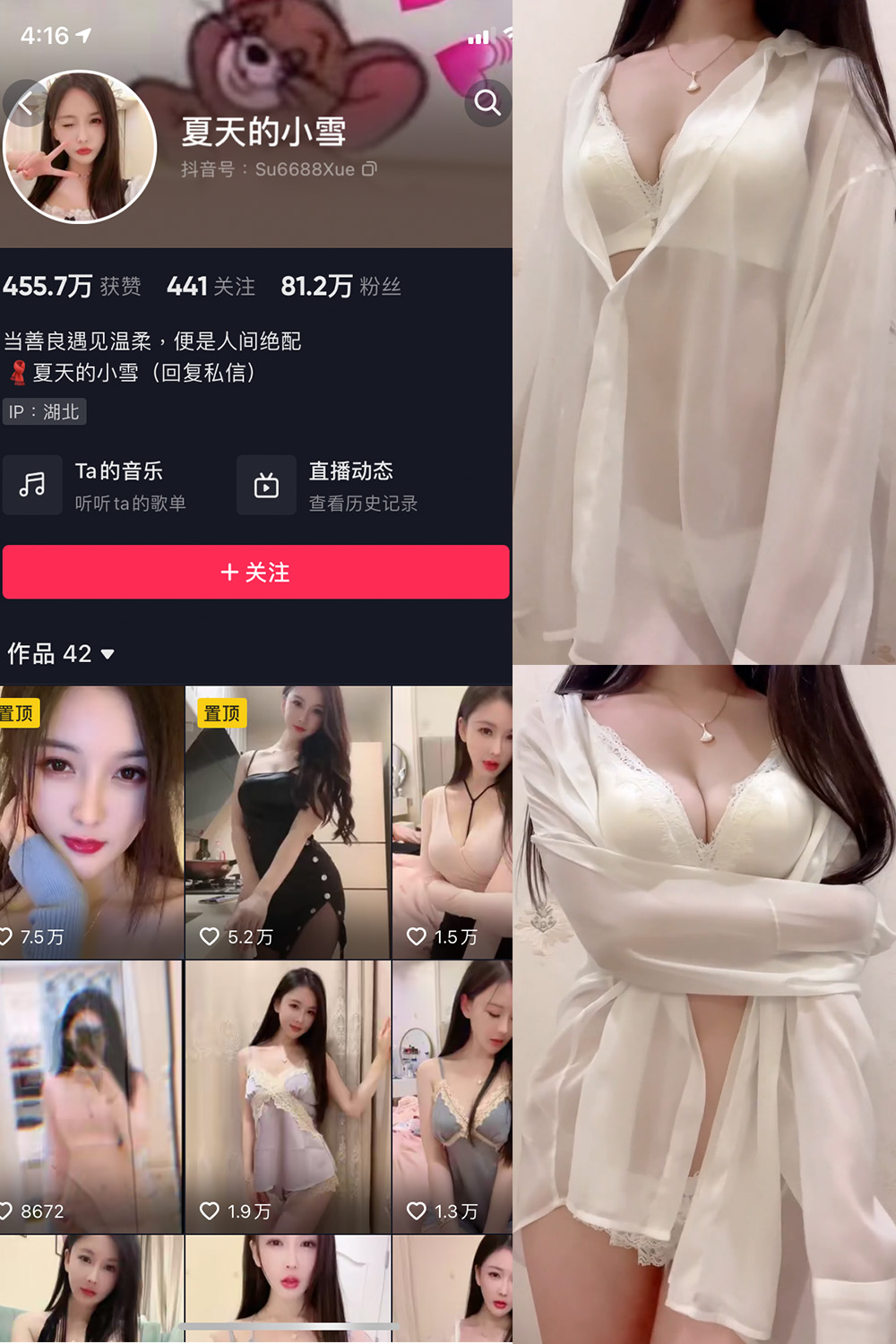 抖音 夏天的小雪 微密圈 嘉宾专享 NO.001-011期 最新至:2023.8.11 抖音 夏天的小雪 微密圈 嘉宾专享 NO.001-011期 最新至:2023.8.11