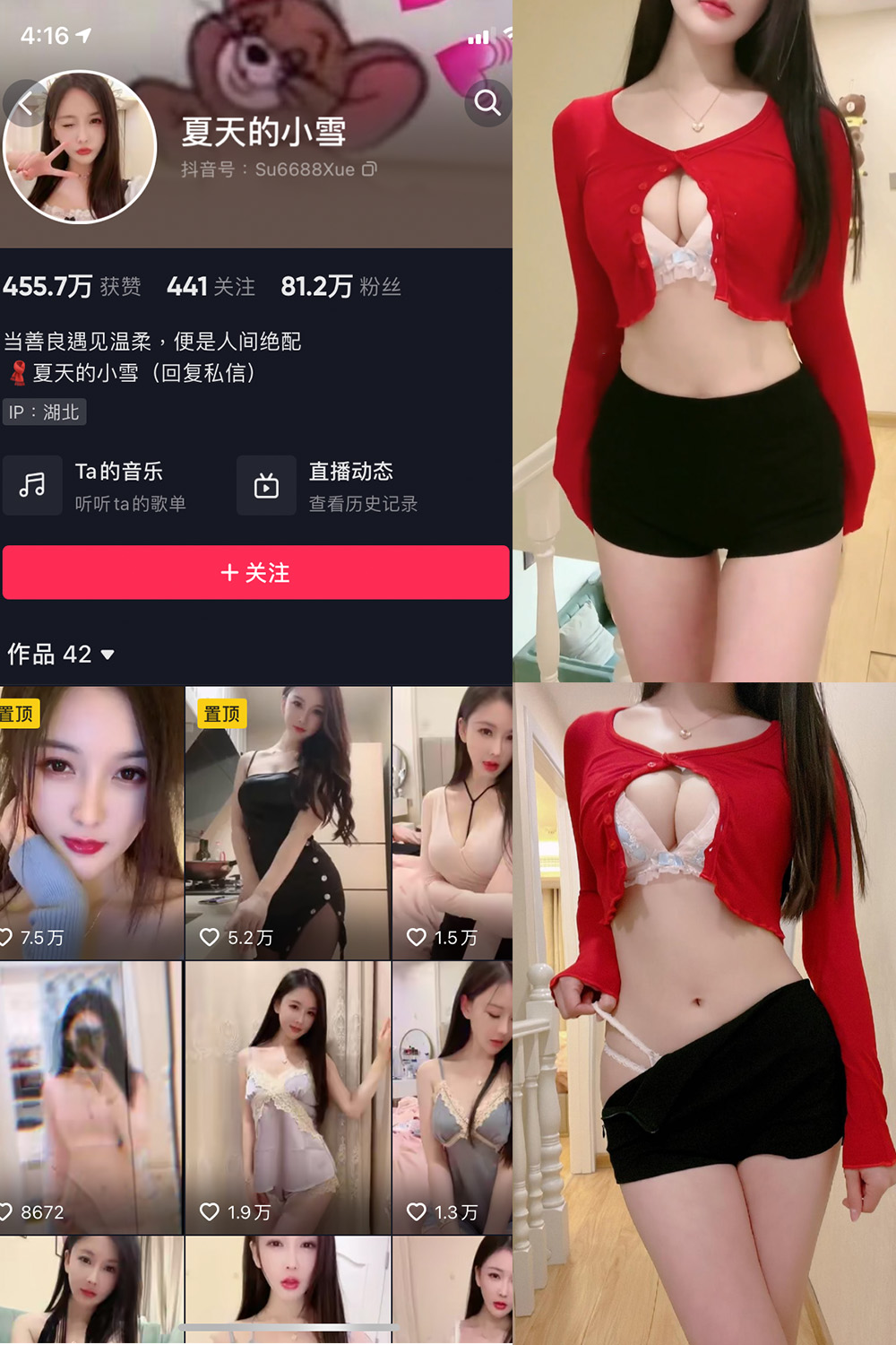 抖音 夏天的小雪 微密圈  NO.006期 【3V】 抖音微密 第1张-玩偶兔 抖音 夏天的小雪 微密圈  NO.006期 【3V】 抖音微密 第1张